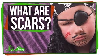What are Scars?