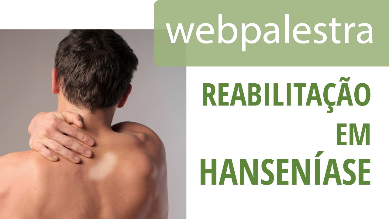 Webpalestra - Prevenção da incapacidade física e reabilitação em hanseníase