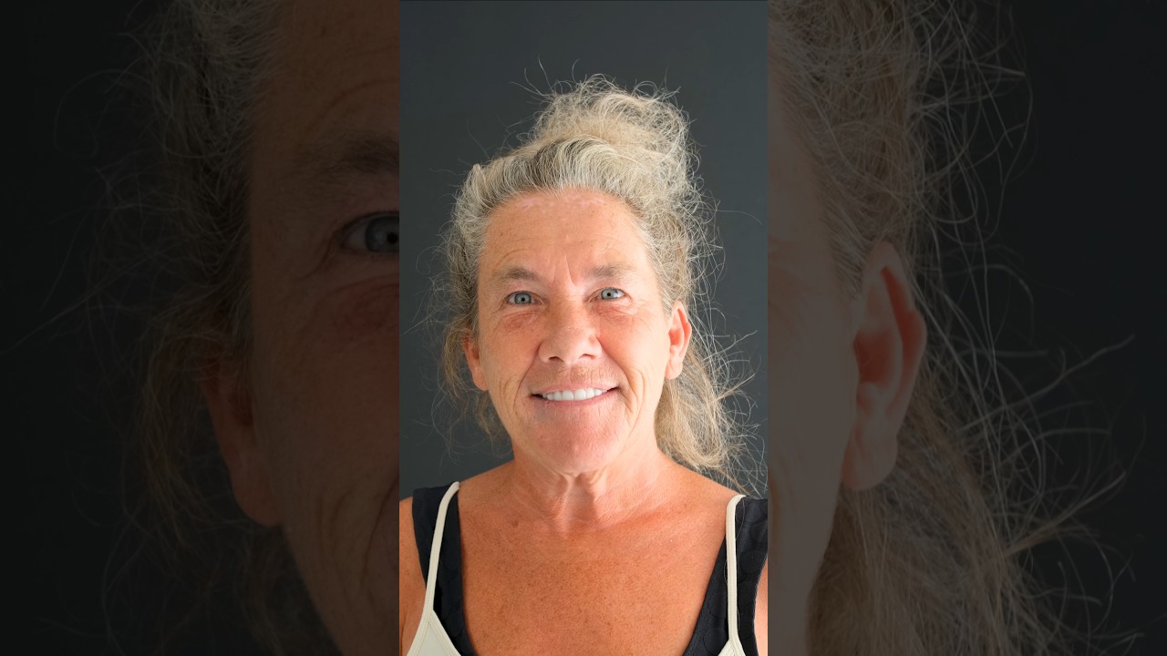 All-on-6 – 1M1 – Натуральный стиль - Video