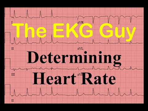 EKG/ECG Determining Heart Rate - Question 8.0 | The EKG Guy