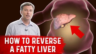 How to Reverse a Fatty Liver