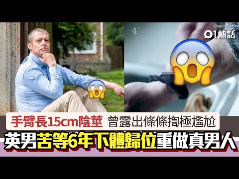 長陰莖
