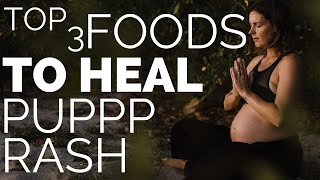 How to Heal a PUPPP Pregnancy Rash with Foods