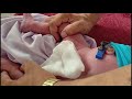 بچوں کا ختنہ کیسے کیا جاتا ہے  || Seven days old baby KHatna How To Do in islam