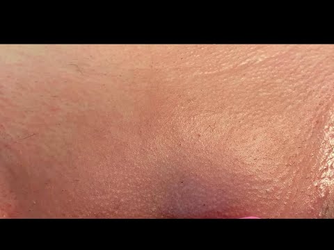 Brazilian Waxing no irritation: Inner thighs