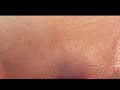 Brazilian Waxing No Irritation Inner Thighs