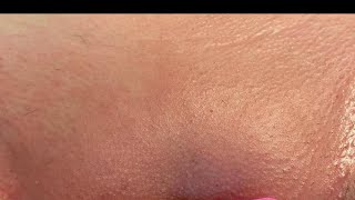 Download lagu Brazilian Waxing no irritation: Inner thighs mp3 Download lagu Brazilian Waxing no irritation: Inner thighs mp3