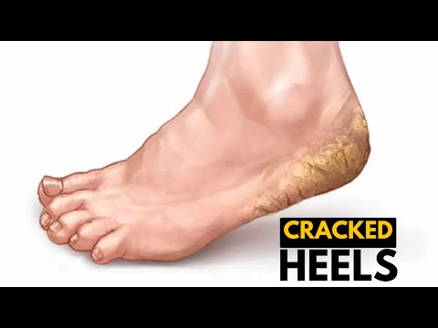 All About Allergy Shots