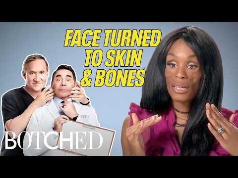 5 storie incredibili di pazienti resilienti in "Botched" | Botched | E!