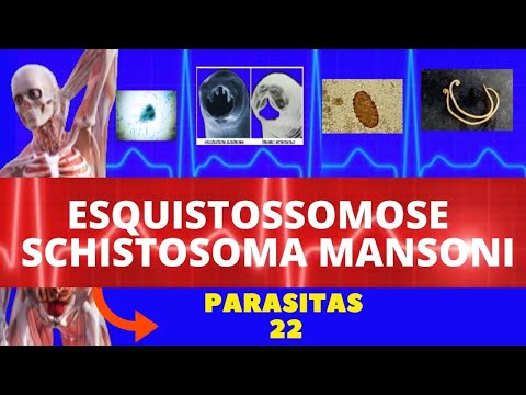 ESQUISTOSSOMOSE - SCHISTOSOMA MANSONI (VERMINOSE) - PARASITOLOGIA| INFECTOLOGIA