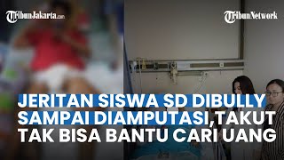 Pilunya Siswa SD Korban Bully, Khawatir Nasib Ibunya Sebelum Diamputasi: Aku Gabisa Bantu Cari Uang