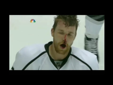 Kings - Coyotes g2 hits and roughs 5/15/12