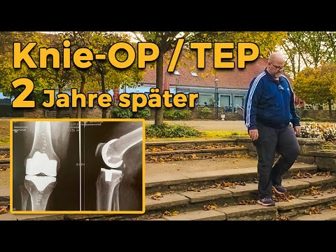 2 Jahre neues Knie – mein ehrlicher Erfahrungsbericht nach der TEP-OP