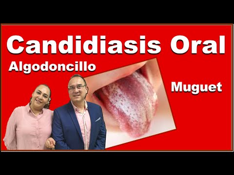 , title : 'CANDIDIASIS ORAL, ALGODONCILLO, MUGUET O SAPITO'