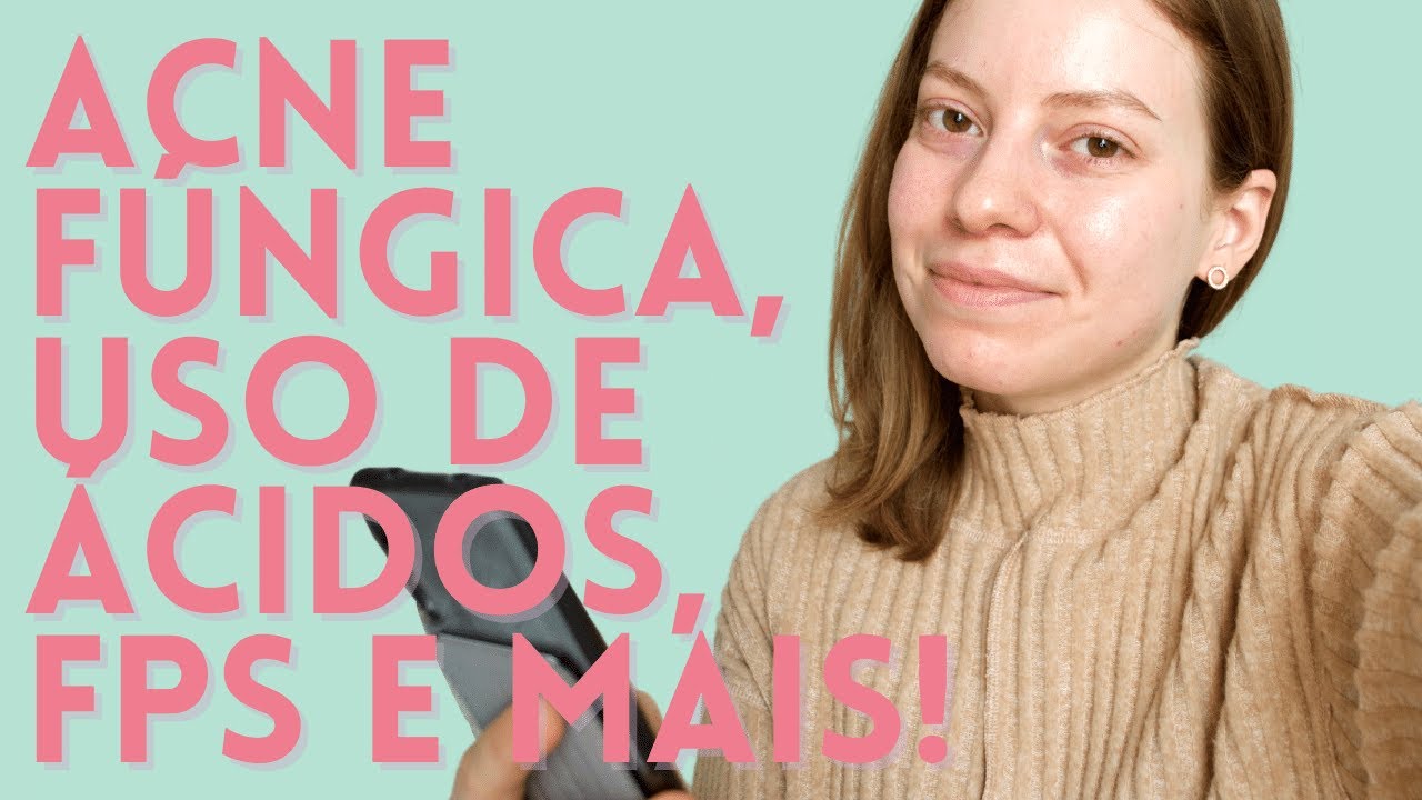 acne e dieta, como usar ácidos para a pele, melhor filtro solar para acne fúngica e mais
