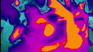 Medicine Man | The Residents