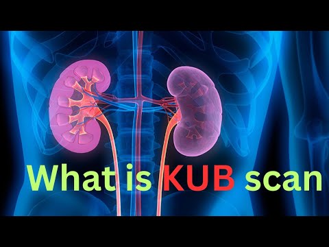 Kidney Urethral bladder scan/ kub scan