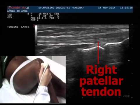 Quanto dura la procedura per una risonanza magnetica della colonna cervicale Metodi insoliti di trattamento delle articolazioni