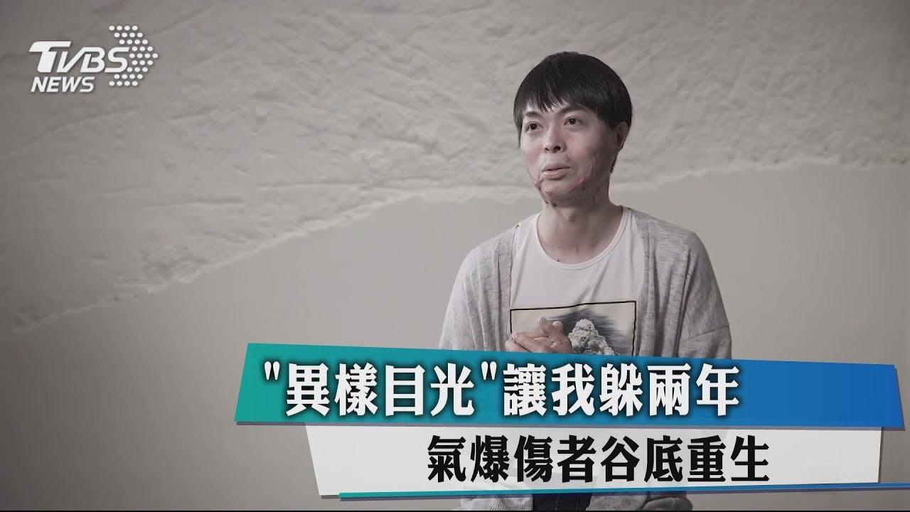 「異樣目光讓我躲2年」　氣爆傷者谷底重生