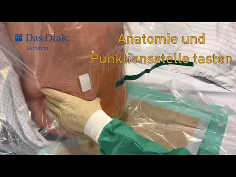 Epidural Anästhesie im Diakonie-Klinikum