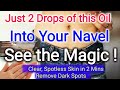 Just 2 Drop Of This Oil In Navel See The MAGIC Get Crystal Clear Spotless Skin Remove Dark Spots
