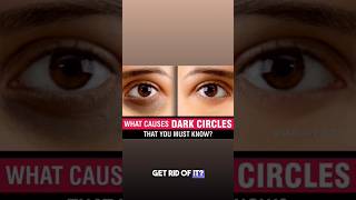 REMOVE DARK CIRCLES EASILY || SKINCARE BOT #shortsfeed #shorts