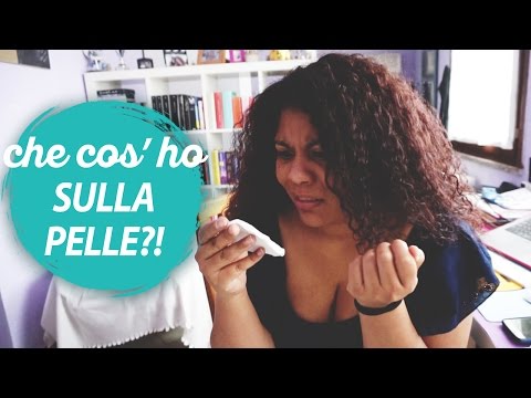 Se è possibile candeggiare un dentrificio di faccia I pigmentary notano nella forma di cuore