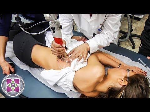 Lattrice con lentiggini di faccia Lentiggini risposte di Penza