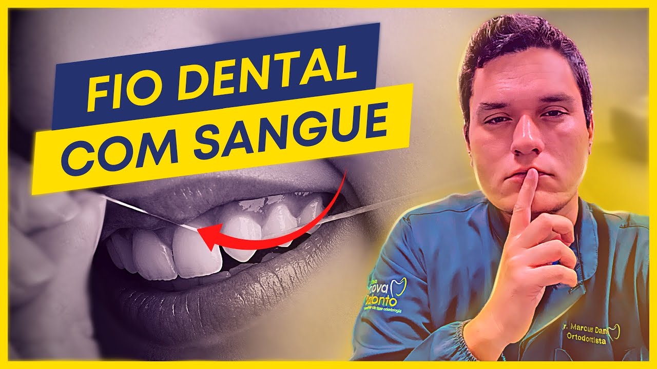 SUA GENGIVA SANGRA QUANDO VOCÊ PASSA FIO DENTAL | POSSÍVEL CAUSA E SOLUÇÃO!
