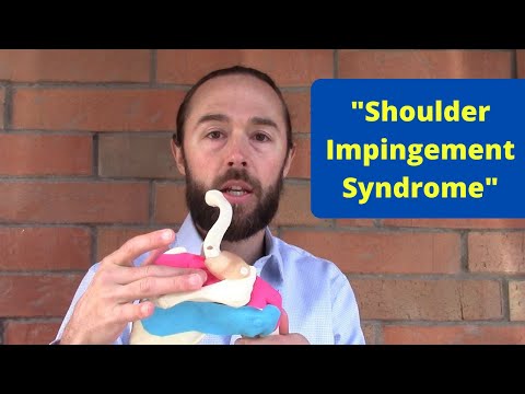 What is "Shoulder Impingement Syndrome"? (shoulder pain)