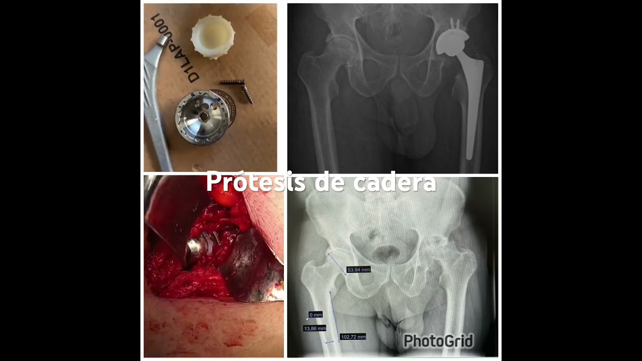 Carlos Tapia Hernández-22