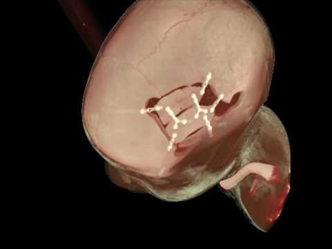 Volumetric rendering of 3D medical scans in the cloud