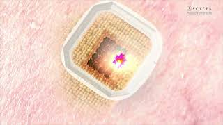 CLASSYS SCIZER Promoción EN TEASER