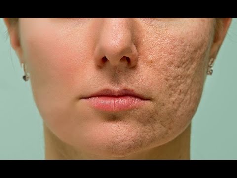 Photoshop tutorial Skin retouching Special technique