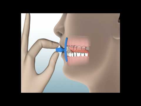 FaceFormer - Zugübung 4