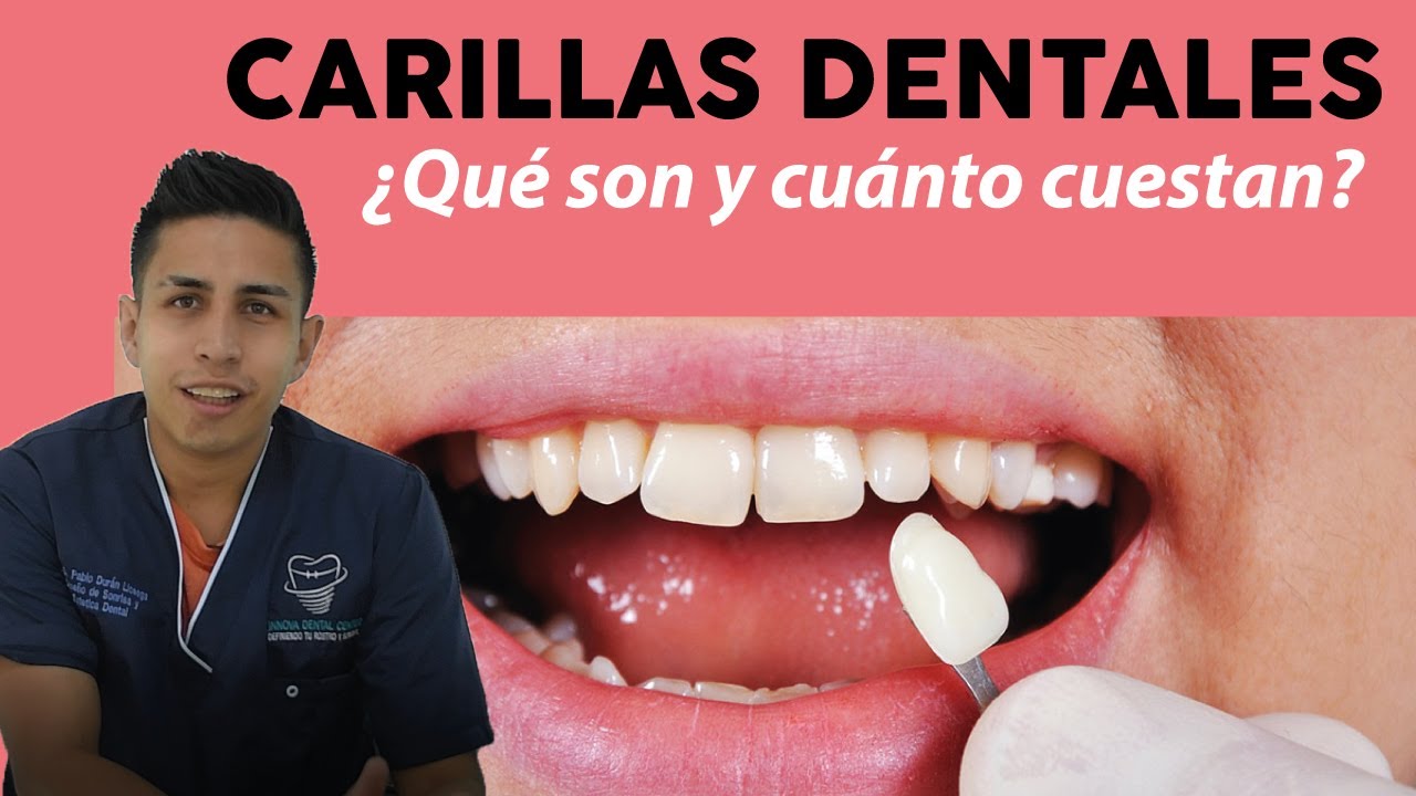 Pablo Duran Liceaga-9