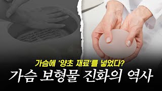 가슴 보형물, 130년 동안 어떻게 발전했을까?