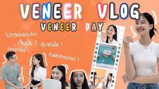 Download lagu Veneer Vlog! Veneer Day🦷 ไปทำวีเนียร์กันจ้า | nanaryy mp3 Download lagu Veneer Vlog! Veneer Day🦷 ไปทำวีเนียร์กันจ้า | nanaryy mp3