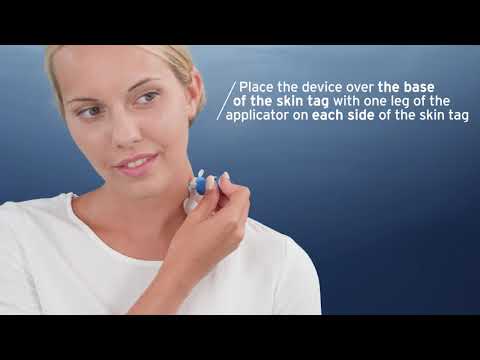 EXCILOR SKIN TAG iINSTRUCTION MOVIE