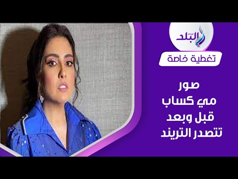 صورة مي كساب تثير ضجة تفاصيل عملية جراحية غيرت حياتها