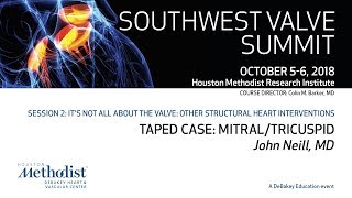 Download Lagu Taped Case: Mitral Tricuspid (John Neill, MD) Thumbnail