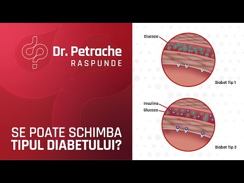 DIABETUL ZAHARAT TIP 2 SE POATE TRANSFORMA IN TIP 1?