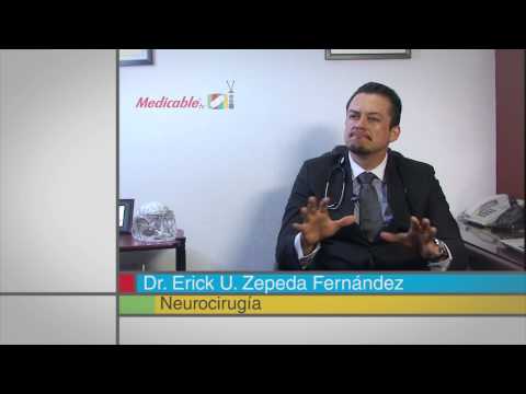 Las convulsiones por un trauma craneoencefálico, ¿son sólo por un periodo?