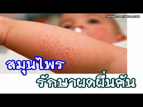 โรคสะเก็ดเงิน perineum คัน โรคสะเก็ดเงินเป็นความเร็ว
