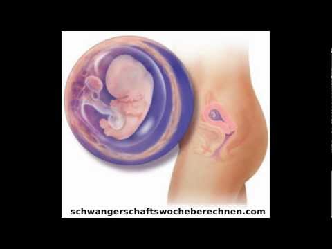 Mit einem eingeklemmten Nerv im zervikalen Diclofenac Blutegeltherapie bei Rückenschmerzen