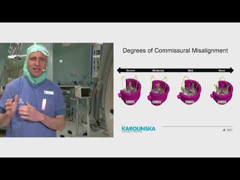 Coronary access after TAVI, a growing need - EuroPCR 2021