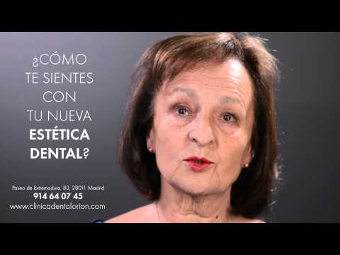 Testimonio Ana María - Estética Dental Madrid - Implantes y Coronas Zirconio - Clínica Dental Orión