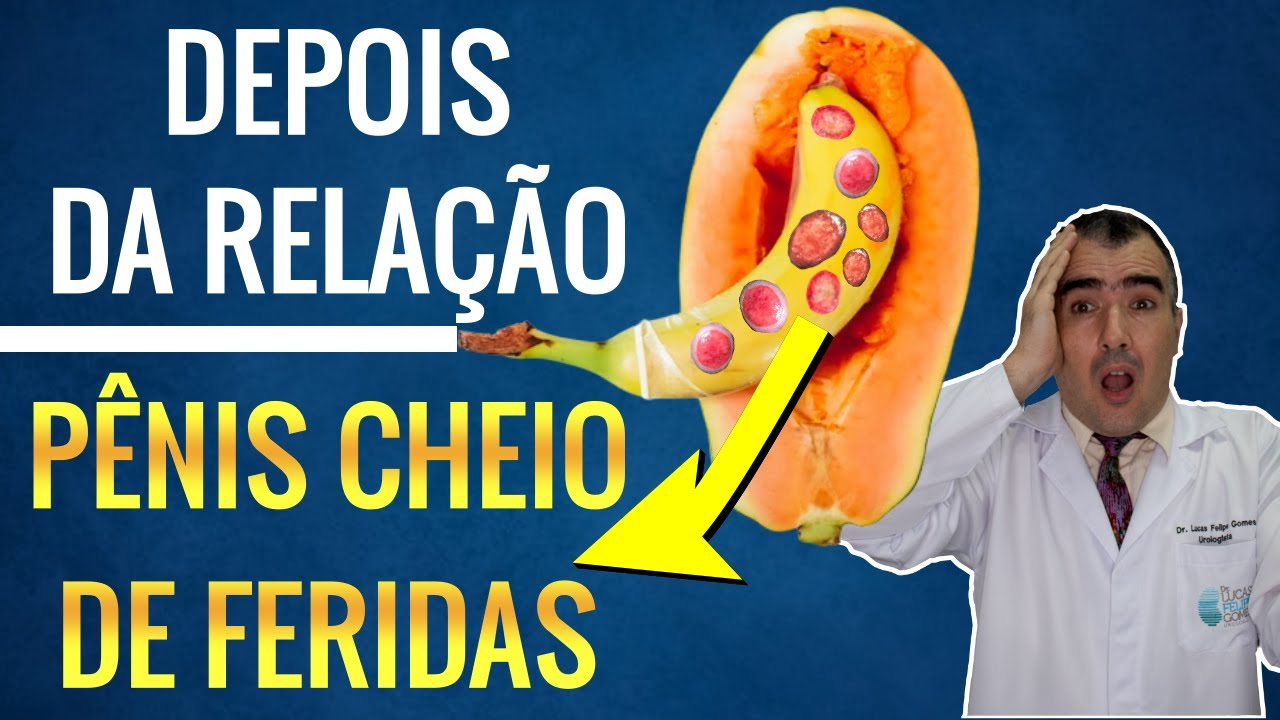 Doenças sexualmente transmissíveis que causam FERIDAS NO PÊNIS!!!