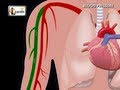 Understanding Blood Pressure Human Anatomy And Physiology Video 3D Animation Elearnin