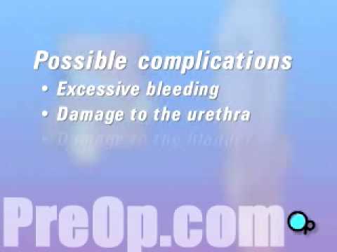 PreOp® Patient Education Cystoscopy Male Surgery